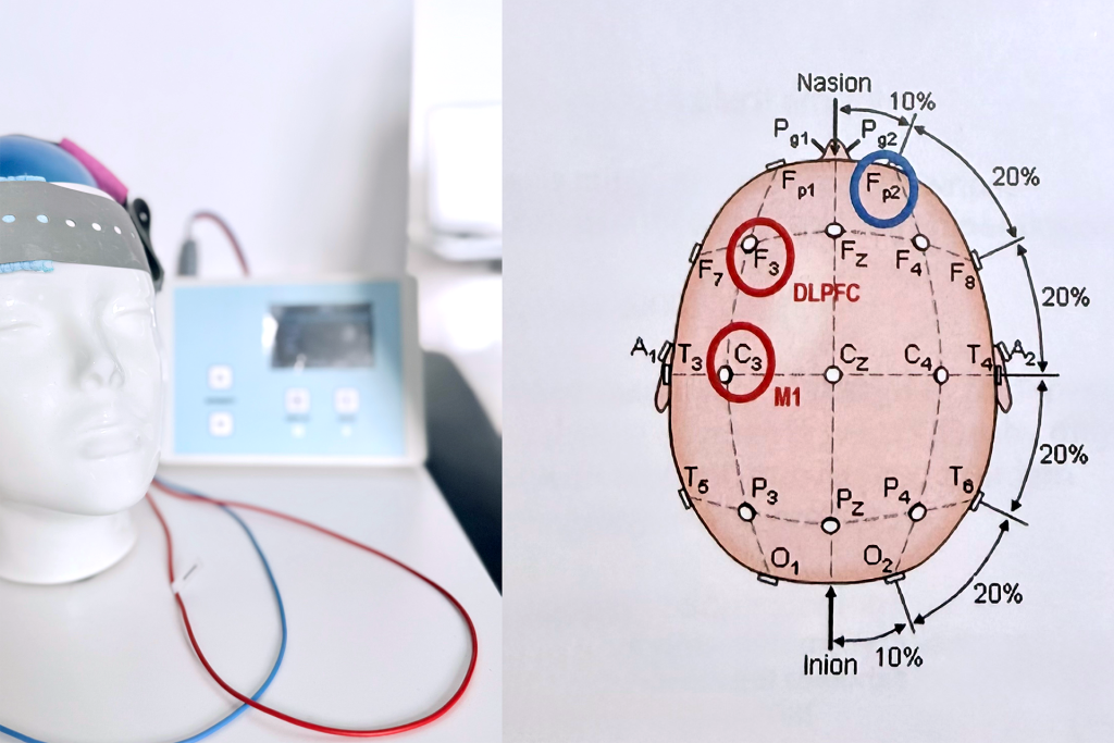 mikropolaryzacja mozgowa tdcs 1s